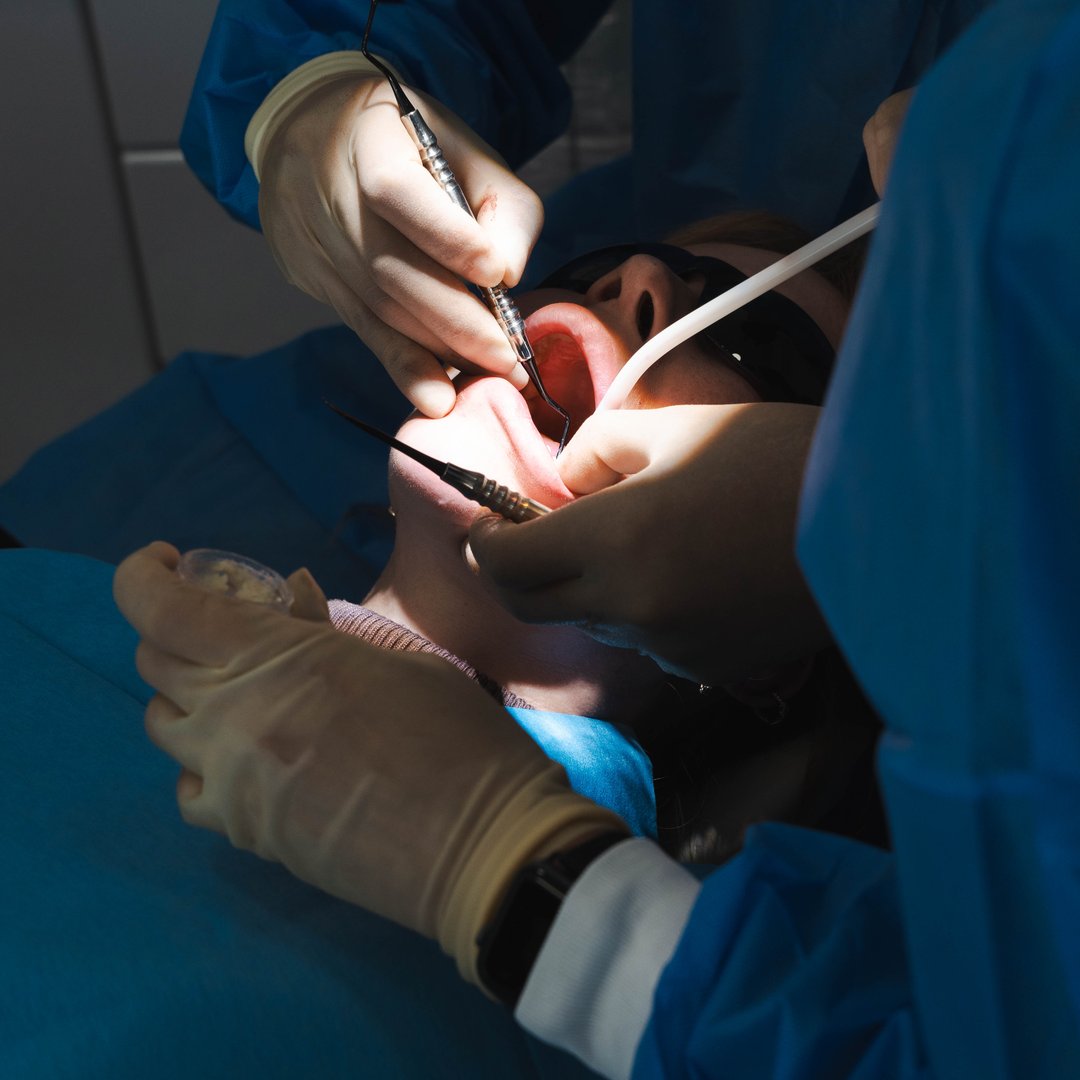 Same Day Tooth Implants, Reading