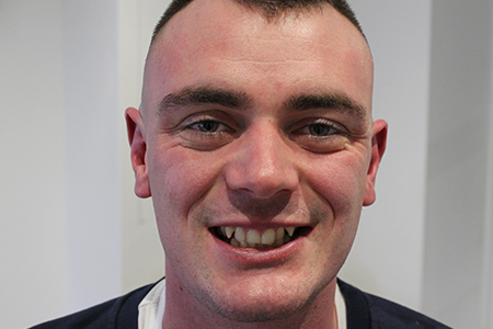 Before Invisalign Treatment Smile Rooms Glasgow