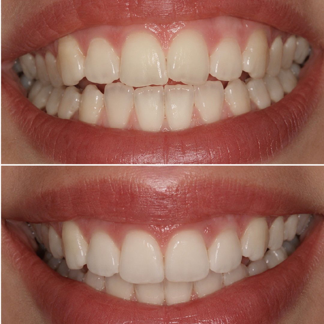 before-and-after1