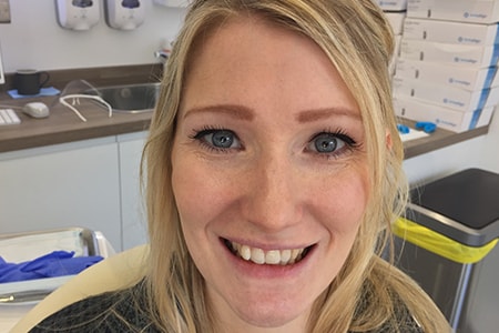 Before Invisalign Treatment Smile Rooms Glasgow