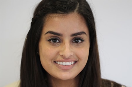 After Invisalign Treatment Smile Rooms Glasgow