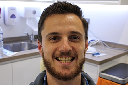 Before Invisalign Treatment Smile Rooms Glasgow