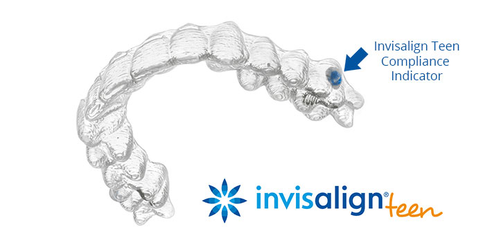 Invisalign Reading - Teeth Straightening Checkendon, Reading