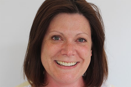 After Invisalign Treatment Smile Rooms Glasgow